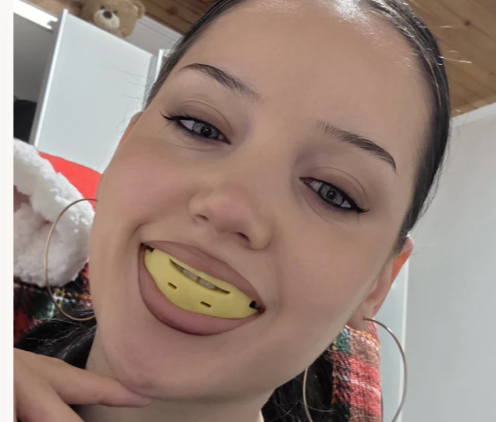 R3 Mouthguard