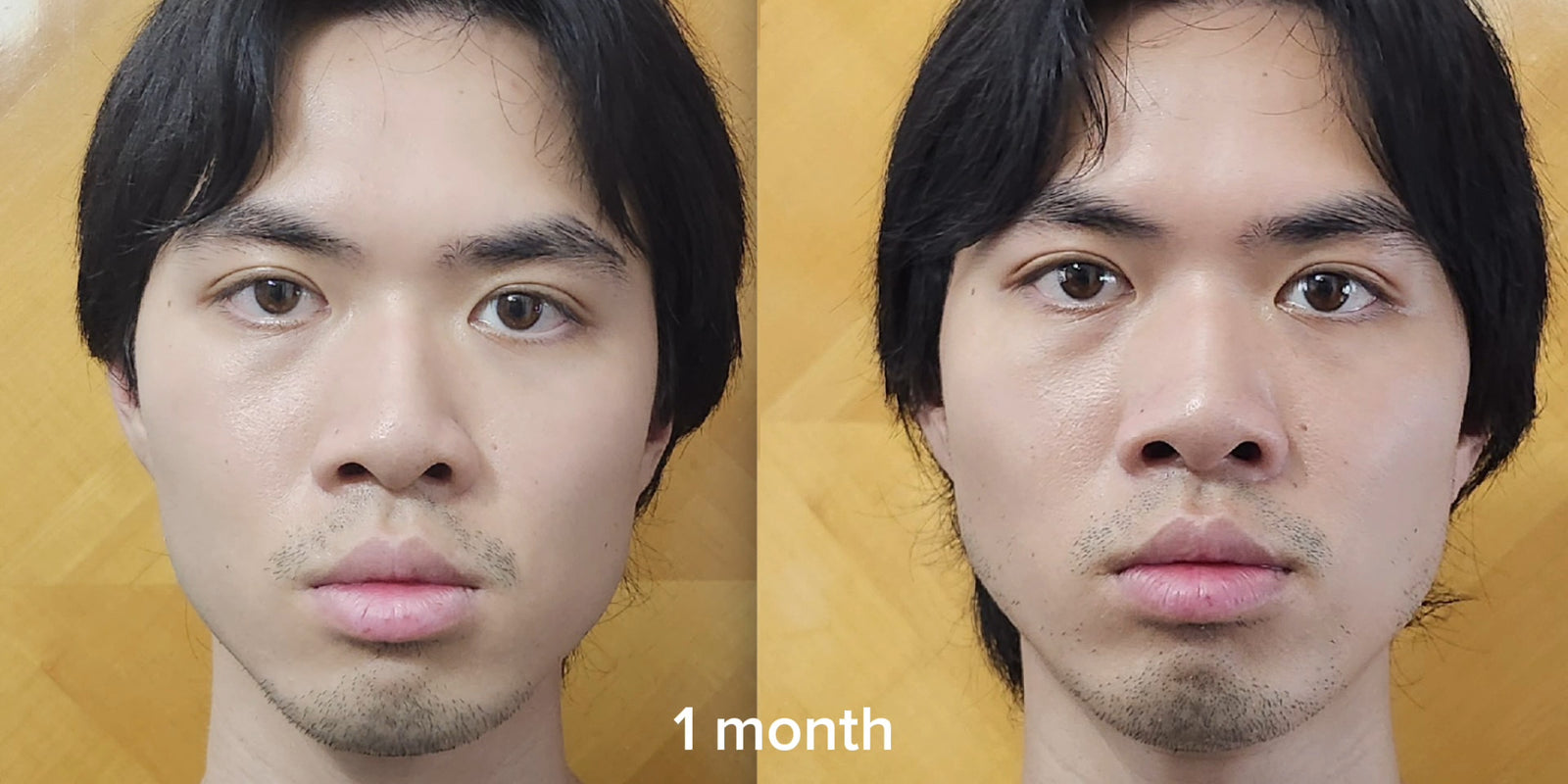 Jawline & lower face ·
