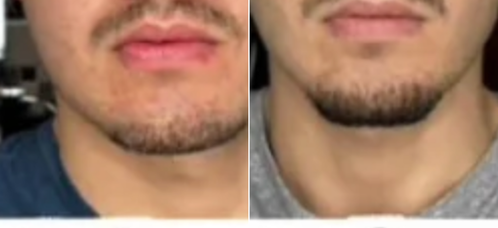 Jawline & lower face ·