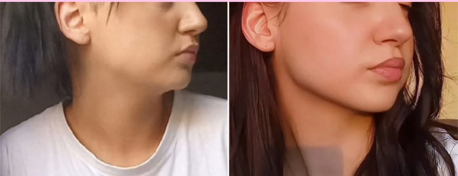 Side profile · sharper chin & neckline